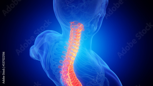 3d rendered medical illustration of a painful upper spine