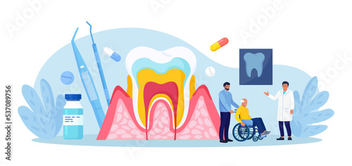Periodontal disease. Doctor dentist checking tooth, examines patient with periodontitis. Dentistry and healthy teeth. Hygiene oral care. Stomatology. Medical dental checkup. Inflammatory gum disease