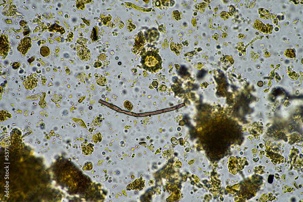 soil fungi under the microscope, soil microbes organisms in a soil and ...