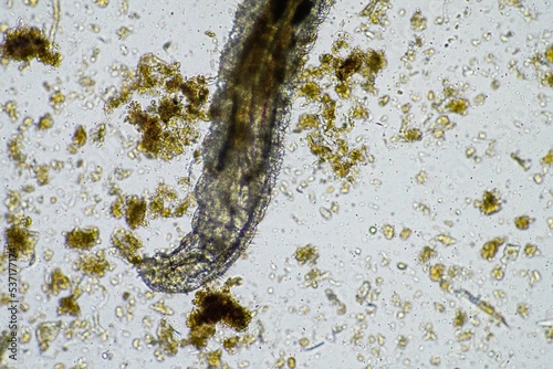 microorganisms and soil biology  with nematodes and fungi under the microscope. in a soil and compost sample 