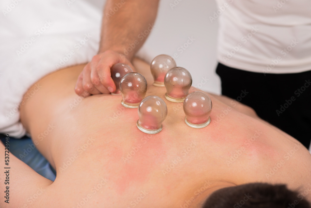 At medical clinic professional therapist doing special vacuum back massage for muscles for his client At medical clinic professional therapist doing special vacuum back massage for muscles for his client