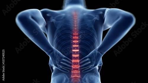 3d rendered medical animation of  a man having backache