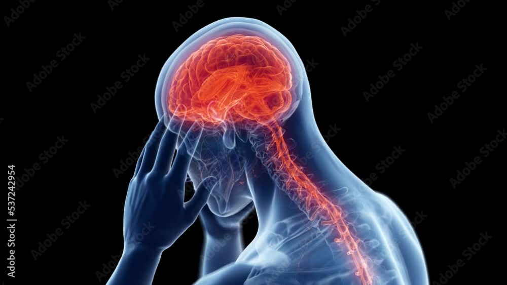3d rendered medical animation of  a man having a headache