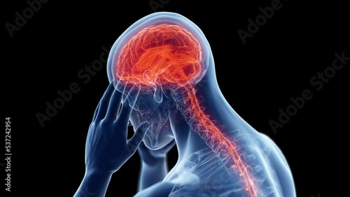 3d rendered medical animation of  a man having a headache photo