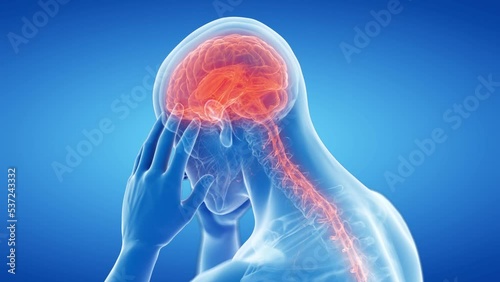 3d rendered medical animation of  a man having a headache