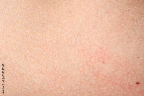 background of a pink skin texture. Healthy skin. Macro photo of skin cells.