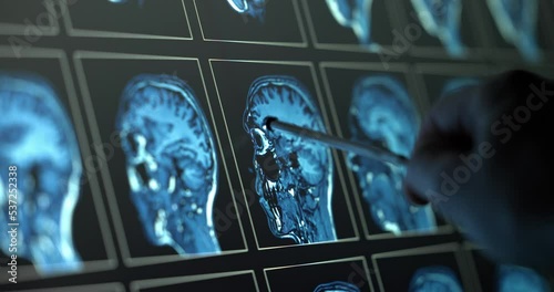 Wallpaper Mural Pointing out and scrolling on medical scan closeup Torontodigital.ca