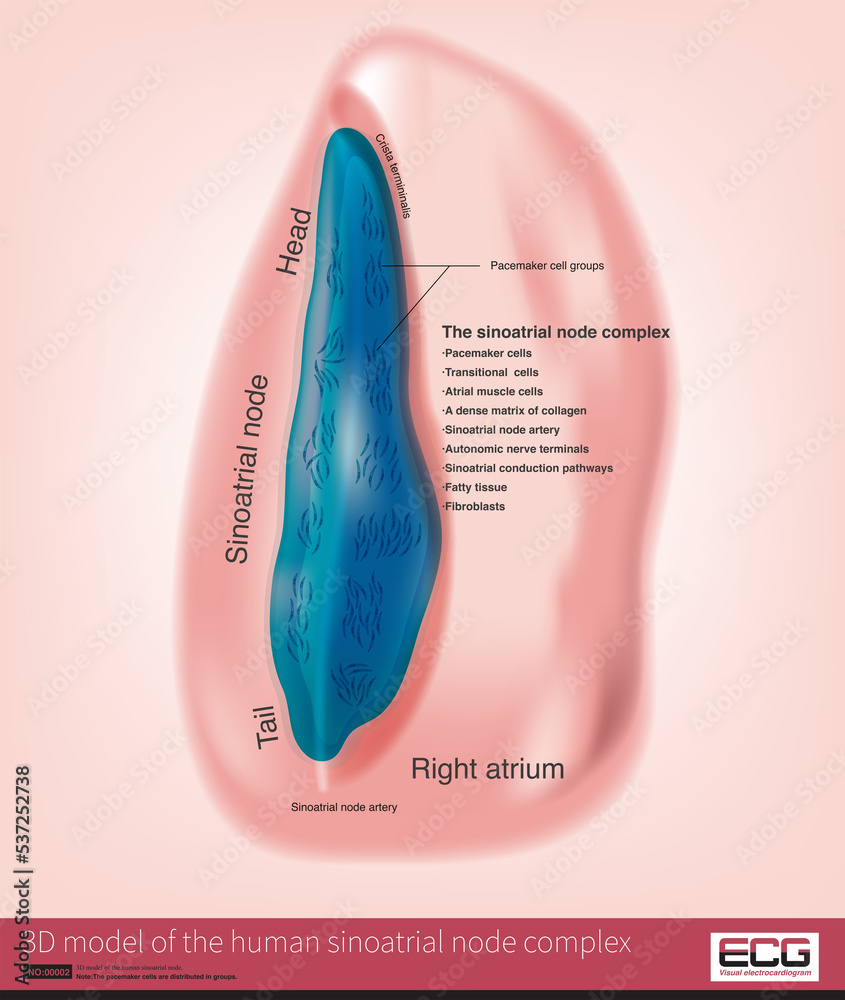 The sinus node is a normal source of heart rhythm in humans and is