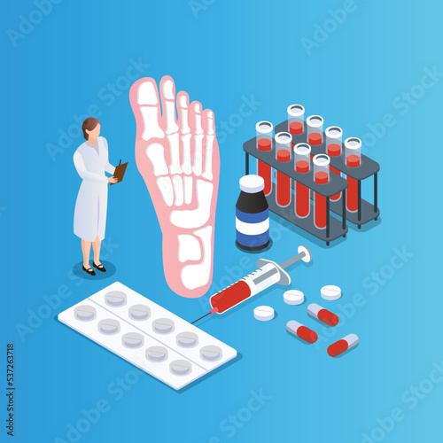 Bone treatment isometric 3d vector illustration concept for banner, website, illustration, landing page, flyer, etc.
