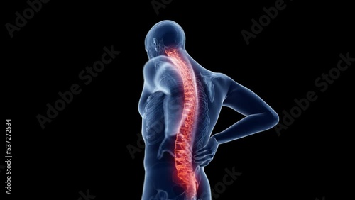 3d rendered animation of  a man having backache photo