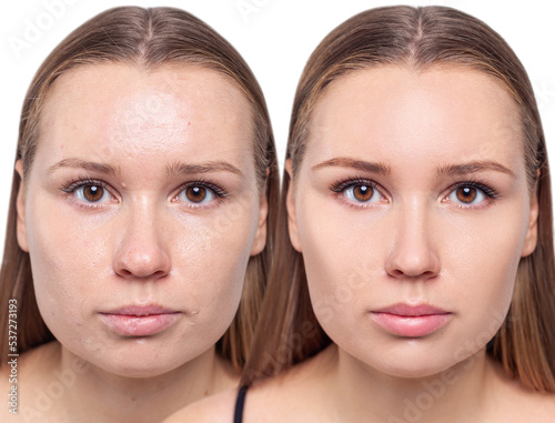 Face of beautiful woman before and after skin retouch.