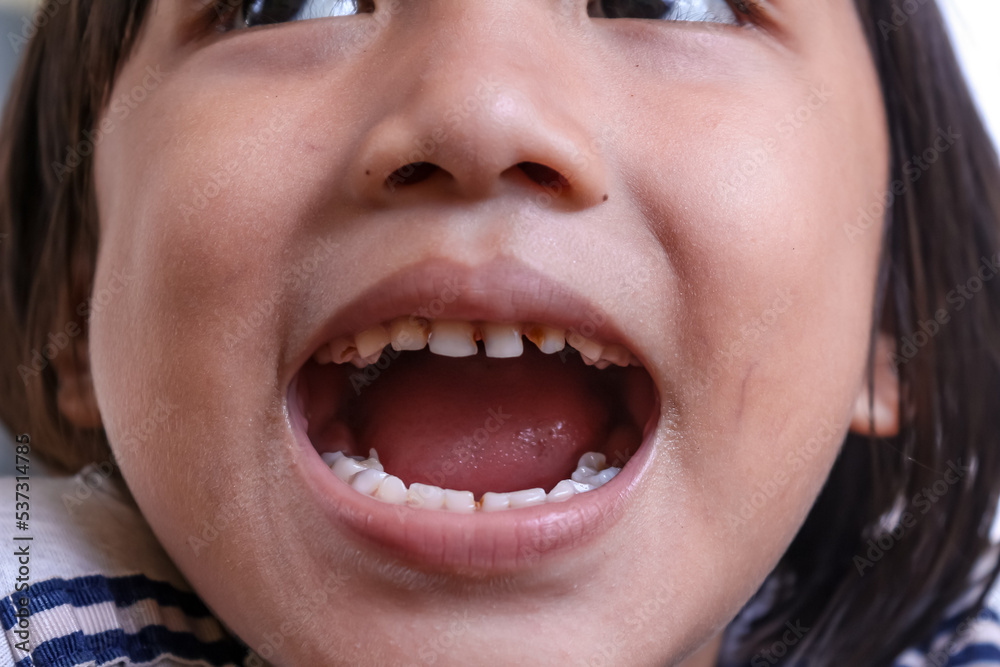 close up of a little girl with a smile showing his teeth close up of a little girl with a smile showing his teeth