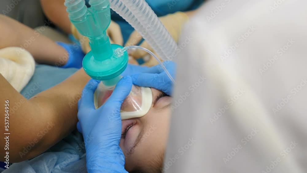 Facial oxygen mask on child. Treatment of child under general anesthesia. Healthcare and life saving. Breathing tube and mask in mouth of kid. Preparing for surgery. Operation in clinic. 4 k video