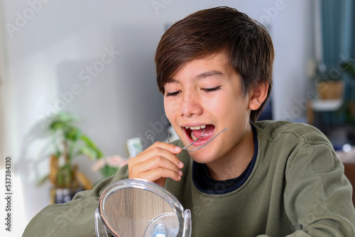 Φωτογραφία Teenager boy with diastema overbite teeth missing gap problem wearing orthodontic appliance treatment infant of the mirror