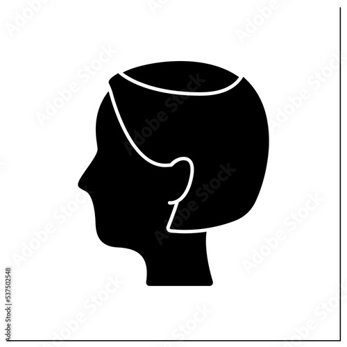 Hair loss glyph icon. Woman loses hair. Thin, see-through look on top of scalp. Hair thinning in vertex. Alopecia concept. Filled flat sign. Isolated silhouette vector illustration
