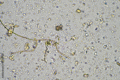 microorganisms and soil biology  with nematodes and fungi under the microscope. in a soil and compost sample