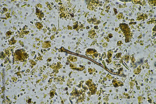 Microorganisms and biology in Compost and soil sample under the microscope  photo