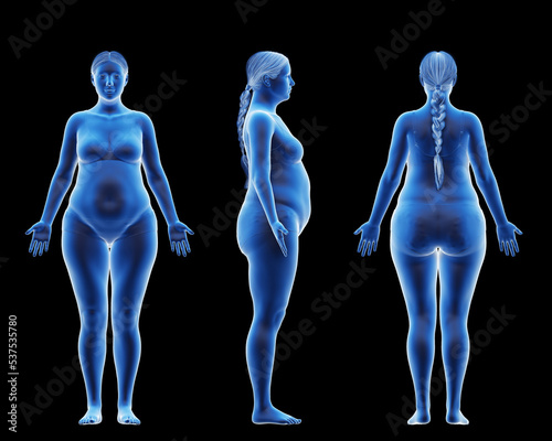 Fototapeta Naklejka Na Ścianę i Meble -  3d rendered medical illustration of a pear shaped female body
