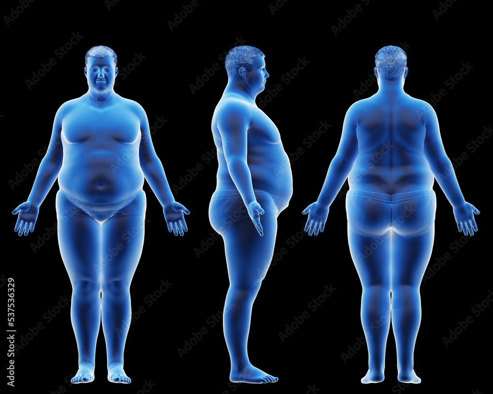 3d rendered medical illustration of an obese male body