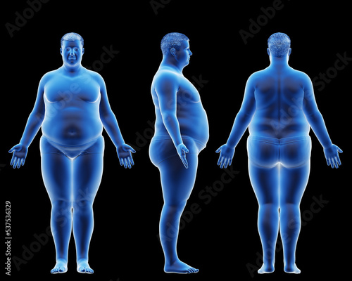 Fototapeta Naklejka Na Ścianę i Meble -  3d rendered medical illustration of an obese male body