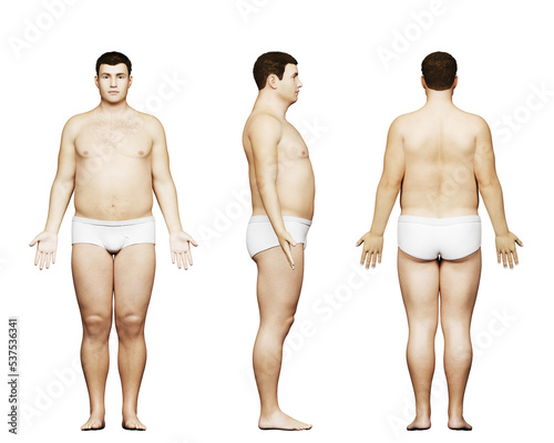 3d rendered medical illustration of a potbellied male body photo