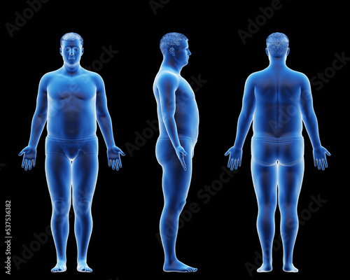 3d rendered medical illustration of a potbellied male body photo