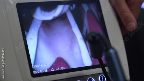 Practice of anesthesiologists on intubation of the respiratory and tracheal organs using a video laryngoscope in a hospital. photo