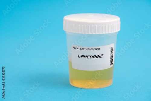 Ephedrine. Ephedrine toxicology screen urine tests for doping and drugs