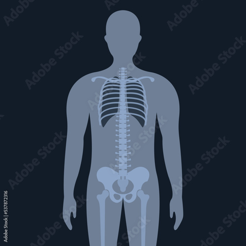 Upright Chest X-Ray for Medical Research and Teaching 