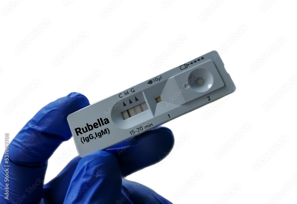 Obraz premium Close view of technician or technologist hand hold a device of Rubella Virus rapid screening test, showing positive IgG and IgM result.