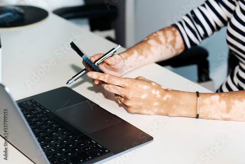 Businesswoman with vitiligo texting