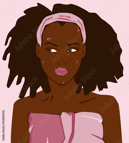 Une jeune femme africaine avec des problèmes de peau, et des boutons d'acné
 photo
