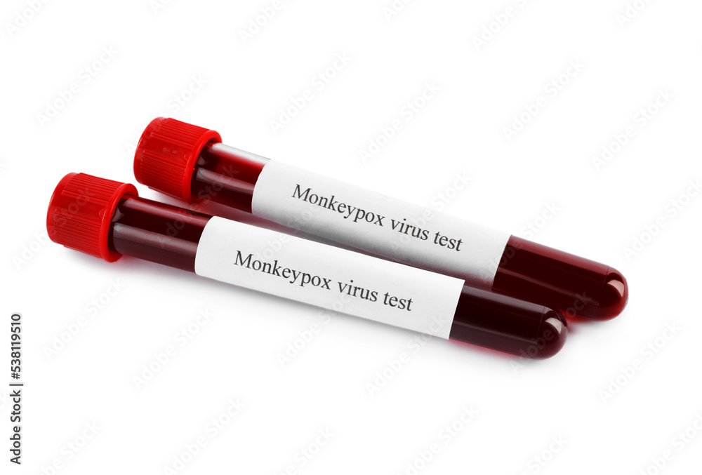 Monkeypox virus test. Sample tubes with blood on white background Monkeypox virus test. Sample tubes with blood on white background