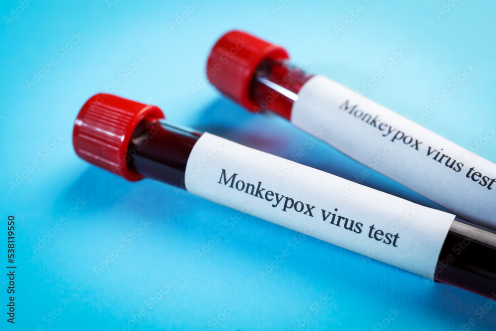 Monkeypox virus test. Sample tubes with blood on light blue background, closeup Monkeypox virus test. Sample tubes with blood on light blue background, closeup