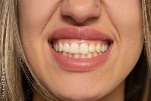 woman shows her beautiful and healthy teeth
