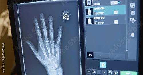 Close up shot of a woman's hand on an x-ray machine.