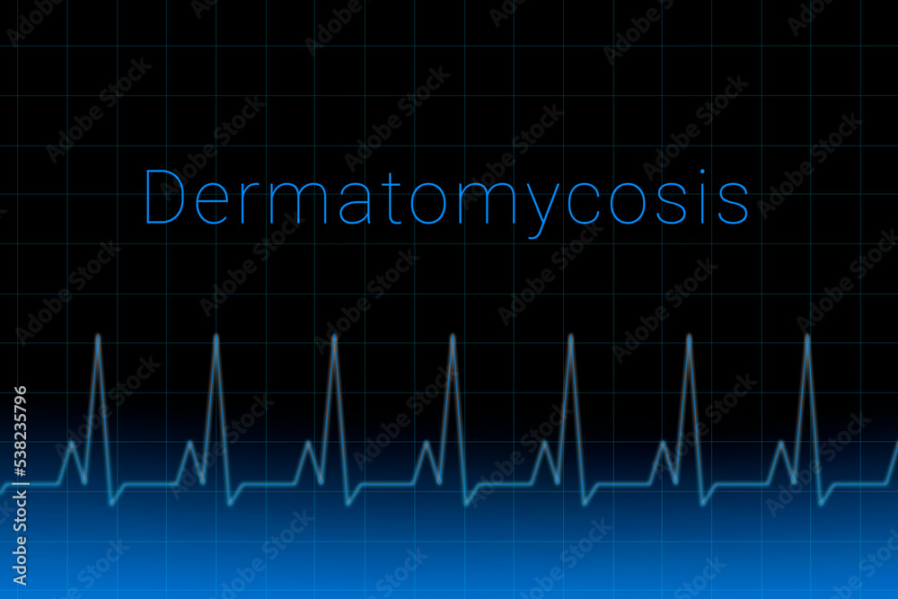 Dermatomycosis disease. Dermatomycosis logo on a dark background. Heartbeat line as a symbol of human disease. Concept Medication for disease Dermatomycosis. Dermatomycosis disease. Dermatomycosis logo on a dark background. Heartbeat line as a symbol of human disease. Concept Medication for disease Dermatomycosis.
