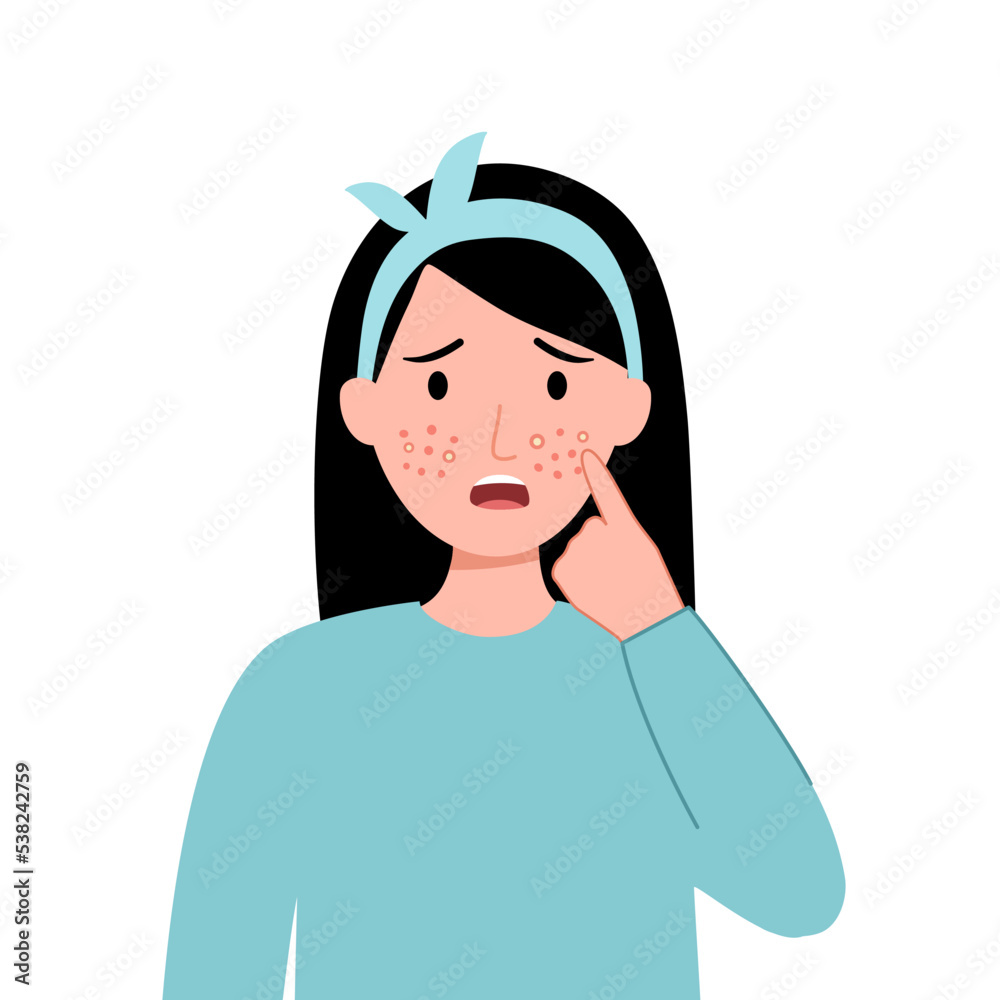 Young woman worrying about her acne on face in flat design. Pimple problem on female skin. Young woman worrying about her acne on face in flat design. Pimple problem on female skin.