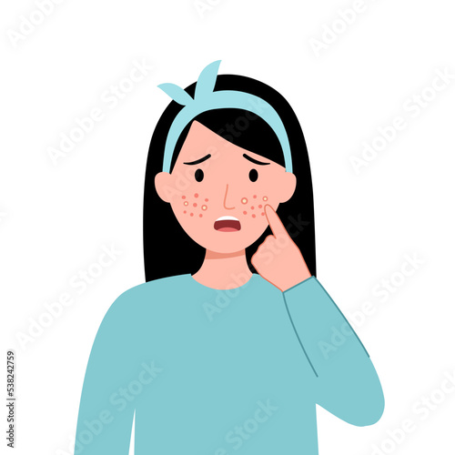 Young woman worrying about her acne on face in flat design. Pimple problem on female skin.