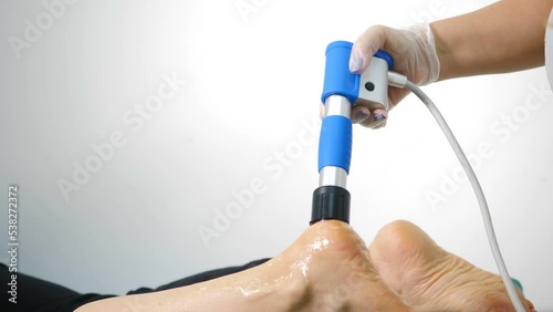 Shockwave treatment for Plantar fasciitis to heal suffering from foot pain while walking, bunion, Hallux Valgus, physical exercise, health care and treatment, exercise, rehabilitation. 4 k video