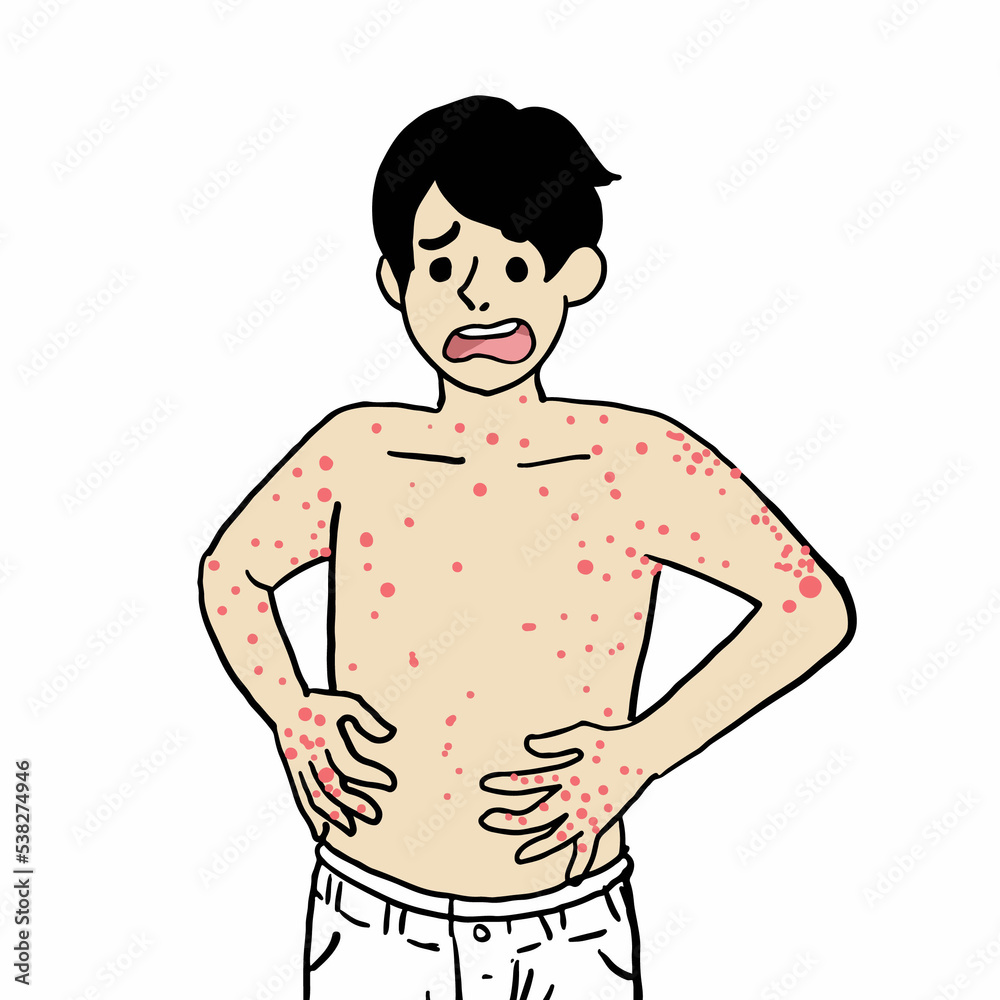 Fototapeta premium cartoon man bitten by mosquitoes all over his body