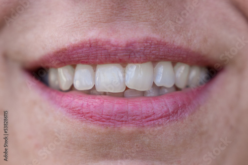 Mouth of a middle aged woman