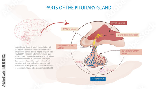 Parts of the pituitary gland, the cause of some diseases such as acromegaly. photo