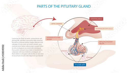 Parts of the pituitary gland, the cause of some diseases such as acromegaly.