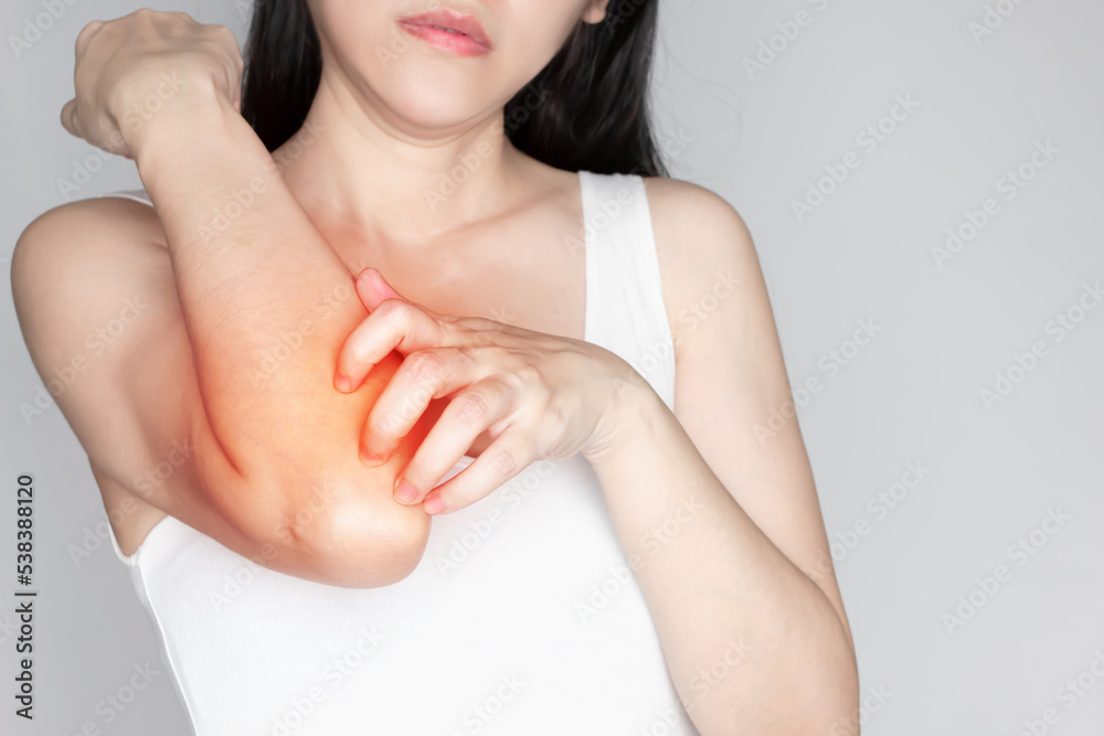 Asian beautiful woman looking elbow and her dryness skin and scratch and itchy, dryness of skin care with a cosmetic makeup. Asian beautiful woman looking elbow and her dryness skin and scratch and itchy, dryness of skin care with a cosmetic makeup.