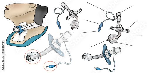 Educational nurse clipart set of hand drawn tracheal cannula in comic style on transparent background photo