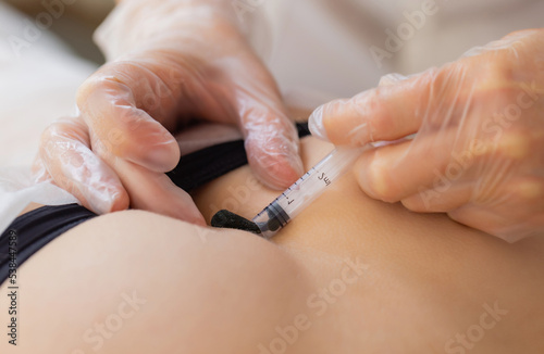 Traditional alternative medicine - doctor doing procedure of hirudotherapy for young woman. photo