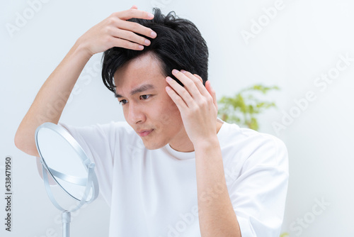 Tableau sur toile 若い男性・薄毛・ハゲ