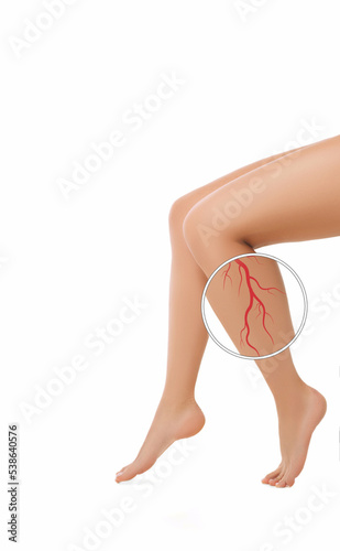 Cropped woman's legs with varicose veins close-up with magnifying glass, isolated on white background. Varicose