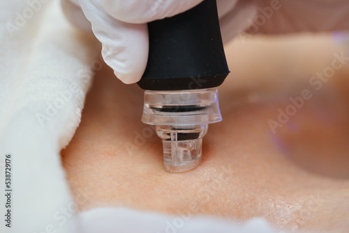 A cosmetologist performs hydropiling in a beauty salon. Skin care. photo